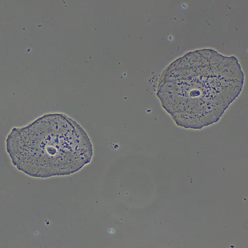 Фазово-контрастное устройство MAGUS PH2 фотография