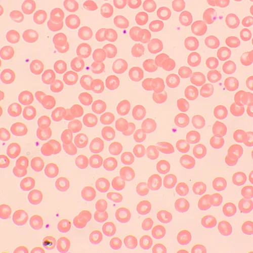 Микроскоп биологический цифровой MAGUS Bio D250TL LCD картинка