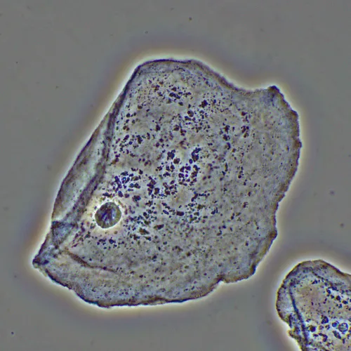 Фазово-контрастное устройство MAGUS PH2 фото