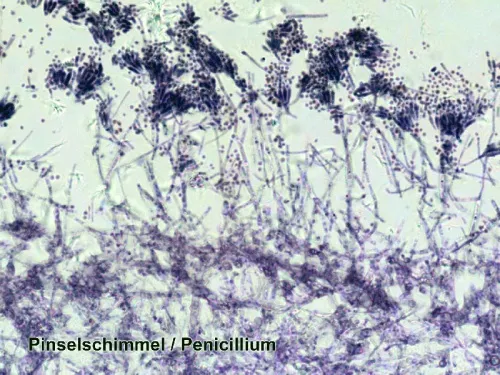 Набор микропрепаратов Bresser 100 шт., в кейсе фотография