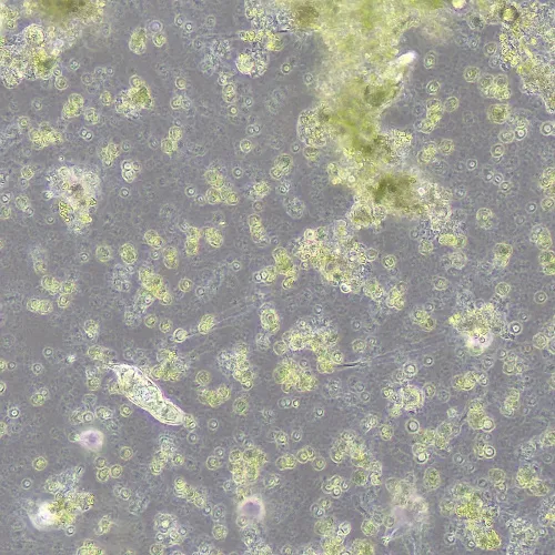 Фазово-контрастное устройство MAGUS SPH360 с набором объективов План ПолуАпохромат Plan S-Apo Ph 4х/10х/20х/40х/60х H60 мм фотография