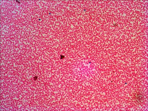 Набор готовых микропрепаратов Levenhuk N38 NG фото