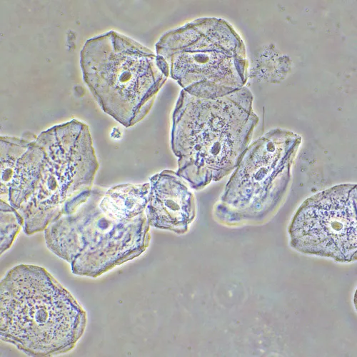 Фазово-контрастное устройство MAGUS SPH2 фотография