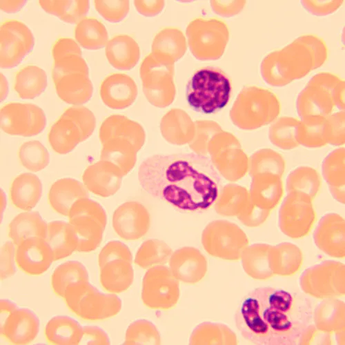 Микроскоп биологический цифровой MAGUS Bio D250T LCD изображение